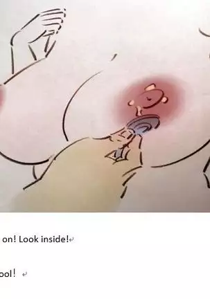 Medical milk医乳